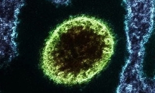 Foto: Reprodução/ Instituto Nacional de Alergia e Doenças Infecciosas dos EUA