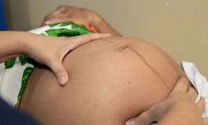 Foto: Divulgação/Semsa