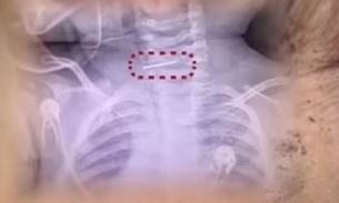 Foto: Reprodução/Redes Sociais