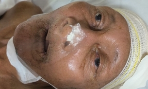 Foto: Divulgação / SES-AM