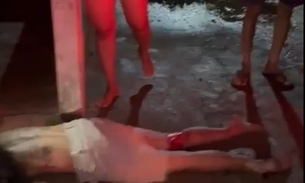 Vítima fraturou as pernas - Foto: Divulgação 