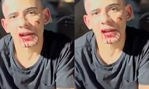 Douglas Alves da Silva afirma que pretendia atropelar outra pessoa / Foto: Reprodução de vídeo