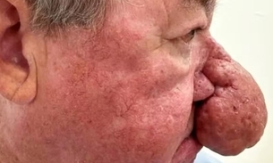 Foto:  Reprodução/Ever Clinic