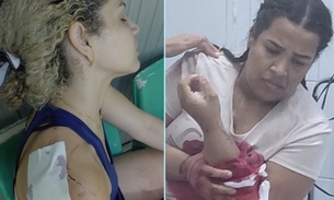 Vítimas foram atacadas - Foto: Arquivo pessoal