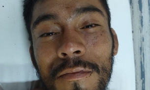 Hospital procura família de homem internado após ser espancado em Manaus