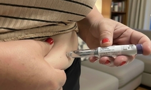 Foto: Divulgação /FVS-RCP