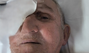 Jonas - Foto: Divulgação 