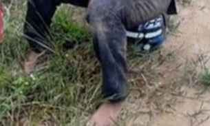 Vítima ficou em estado grave - Foto: Divulgação 