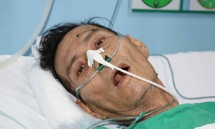 Paciente Marcio Fabricio da Silva Foto: Divulgação