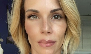 Foto: Ana Furtado, em uma foto onde comparava o rosto com e sem filtro / Reprodução / Instagram