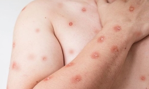 Prefeitura fez alerta - Foto: Divulgação 