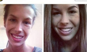 Jovem com anorexia mostra sua batalha como exemplo