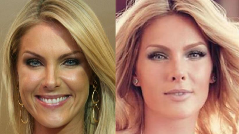 Rosto e nariz de Ana ficaram mais redondinhos. Os olhos também parecem ter sido mexidos e o formato da sobrancelha mudou.