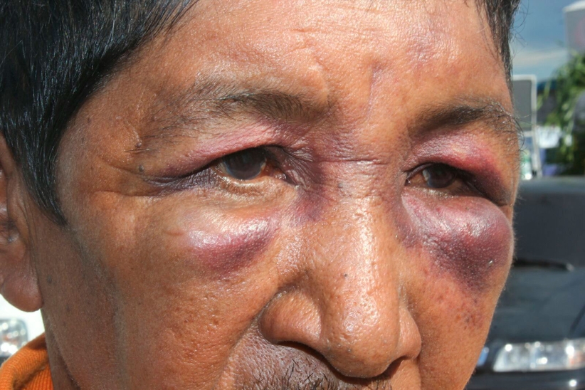 Foto: Pedro Braga Jr. / Portal do Holanda