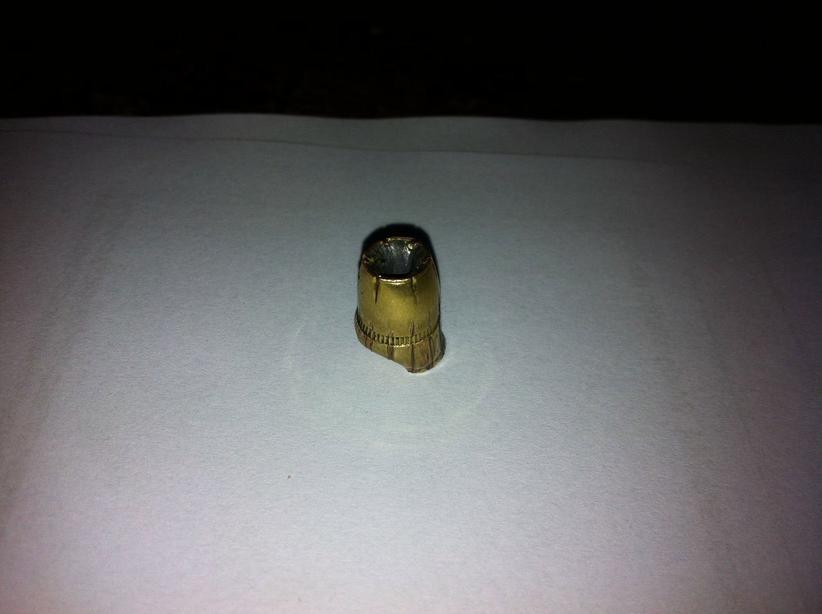 Um dos projéteis que foi removido do corpo da vítima na unidade hospitalar (Foto: Portal do Holanda)