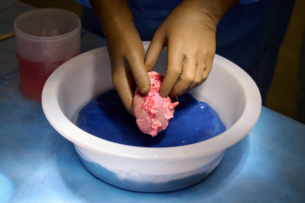 Foto: Joe Carrotta para NYU Langone Health/via Reuters