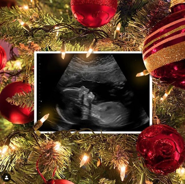 Meghan compartilhou com os seguidores a foto da ultrassom - Foto: Reprodução/ Instagram 