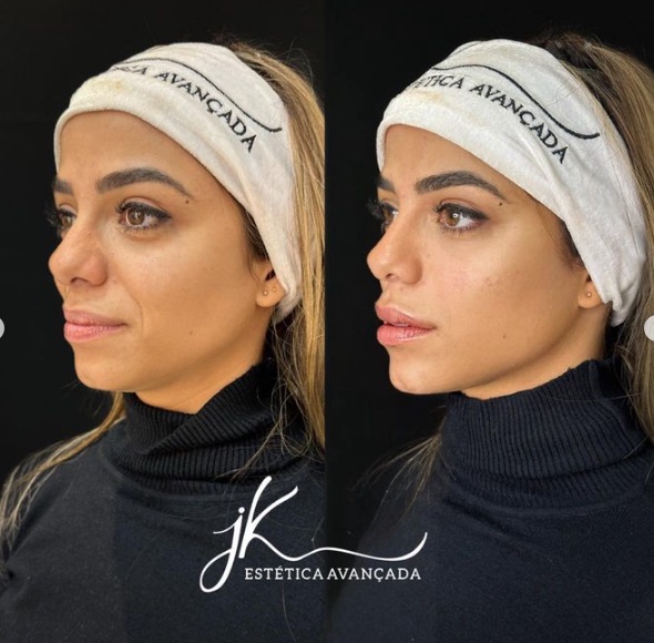 Antes e depois de Key Alves - Foto: Reprodução/Instagram