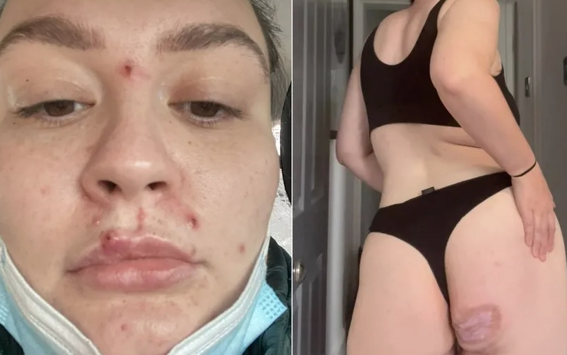 Foto: Reprodução/Kennedy News