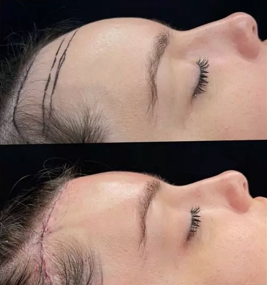 Foto: Reprodução Instagram @thaisbraz