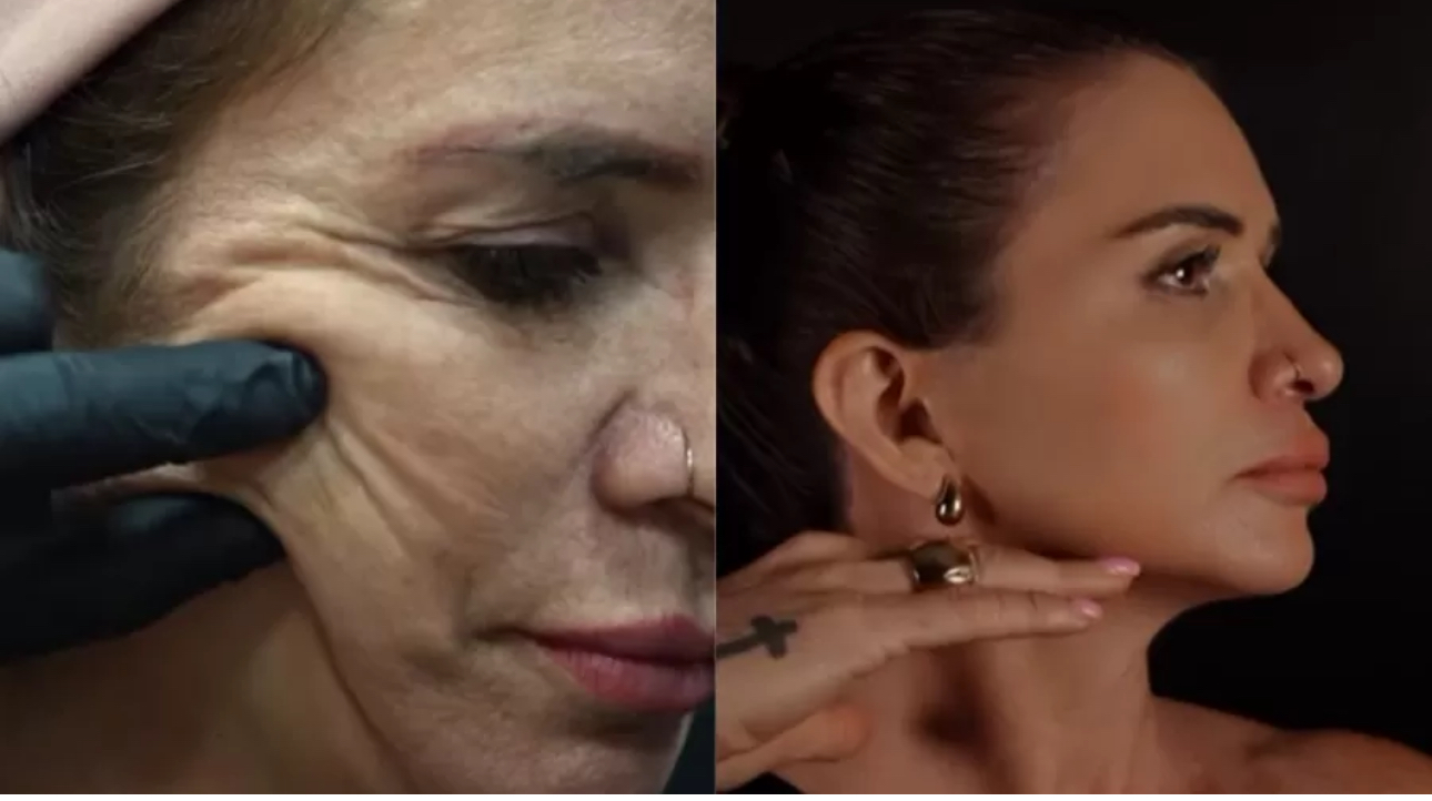 Foto: Reprodução Instagram