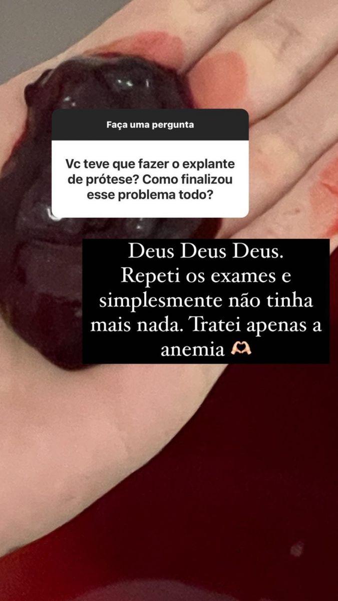 Imagem: Reprodução/Instagram