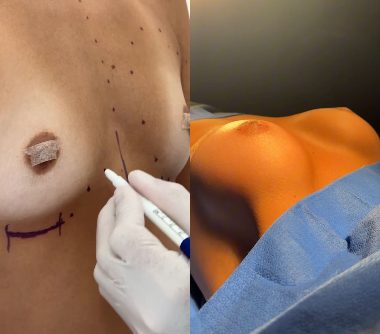 Antes e depois da cirurgia - Imagens: Reprodução/Instagram