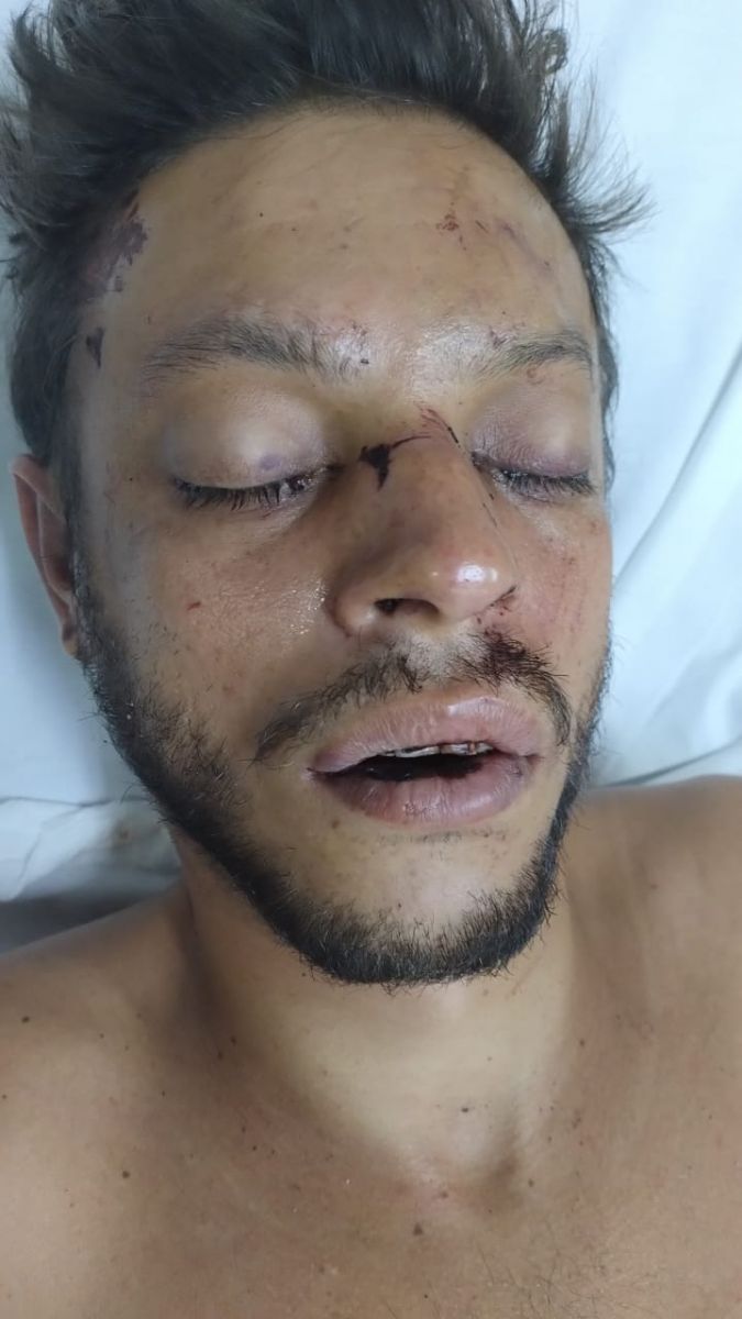 Foto: Divulgação SES-AM