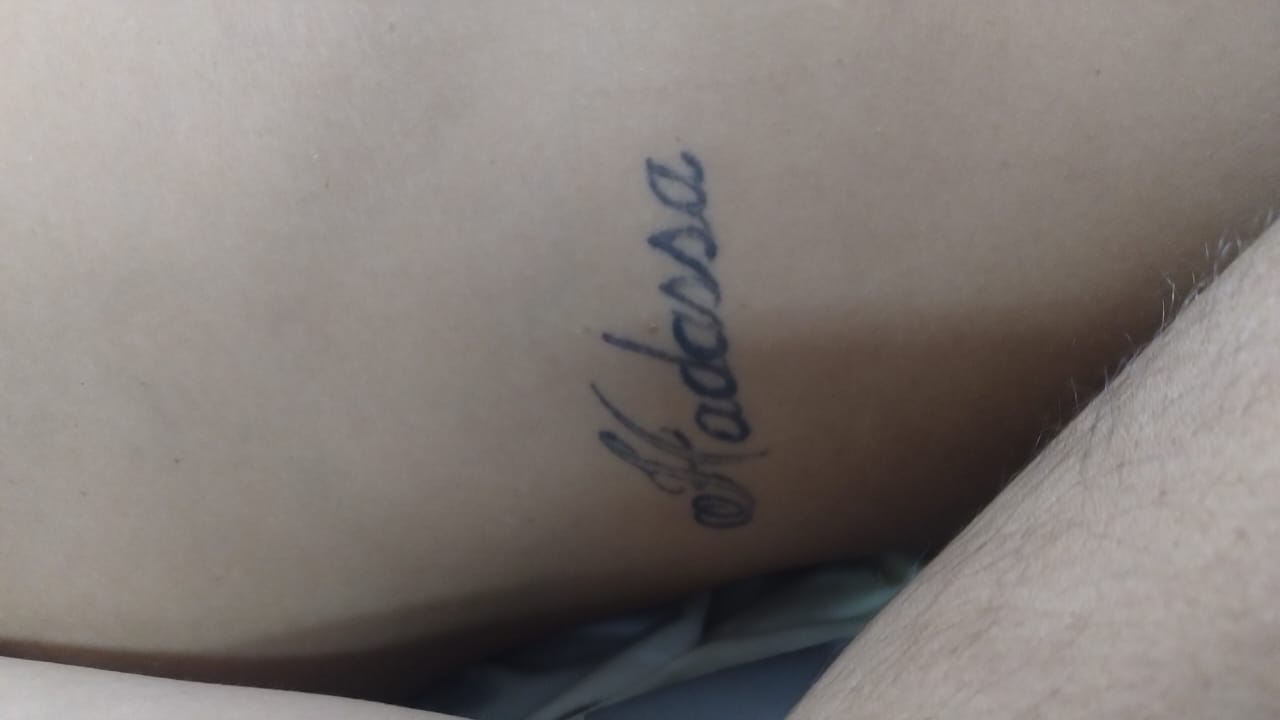 Foto: Divulgação SES-AM