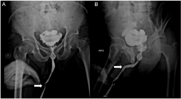Foto: Divulgação Hospital Acadêmico Geral Soetomo
