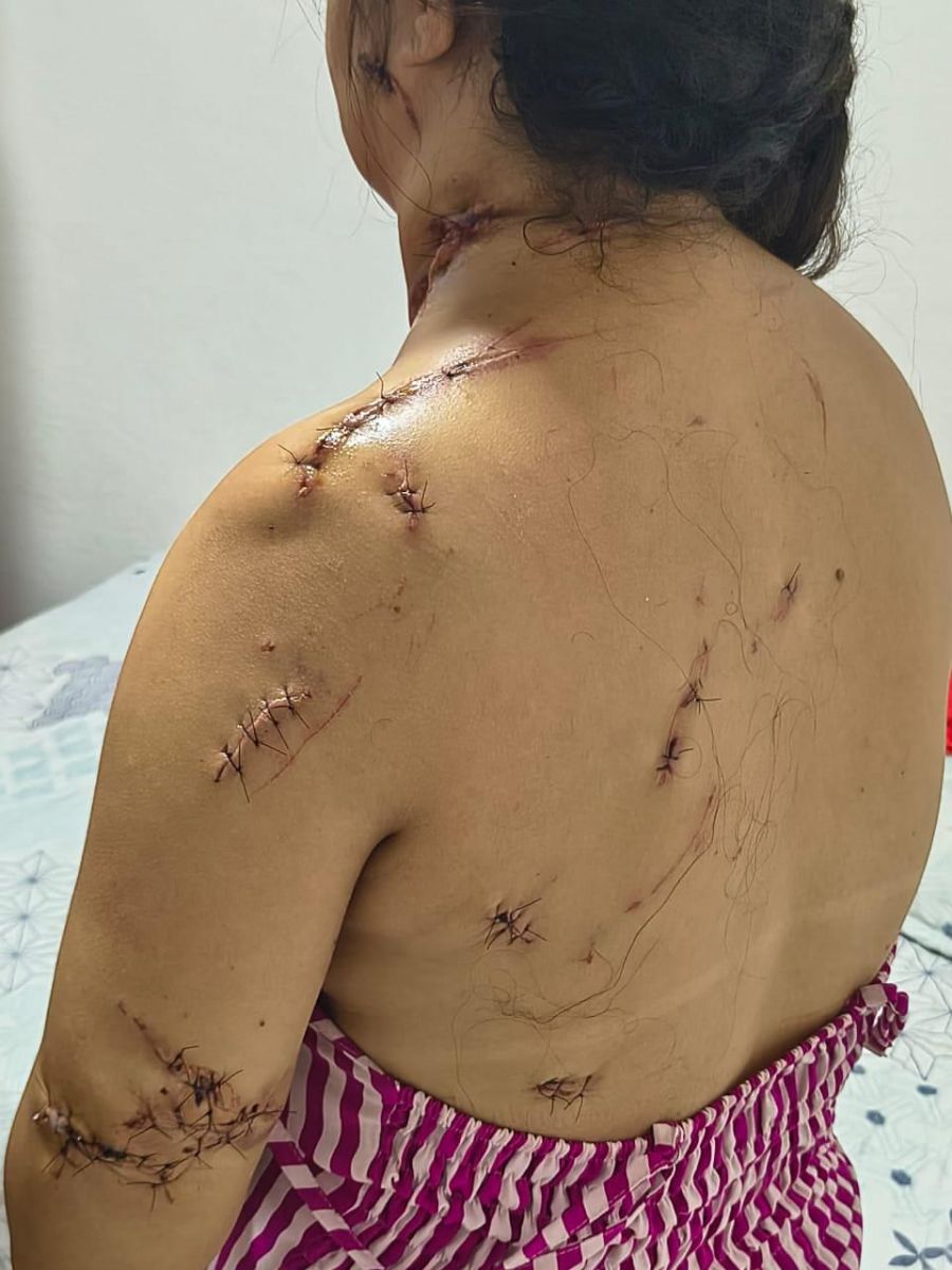 Foto: Neto Silva/Portal do Holanda