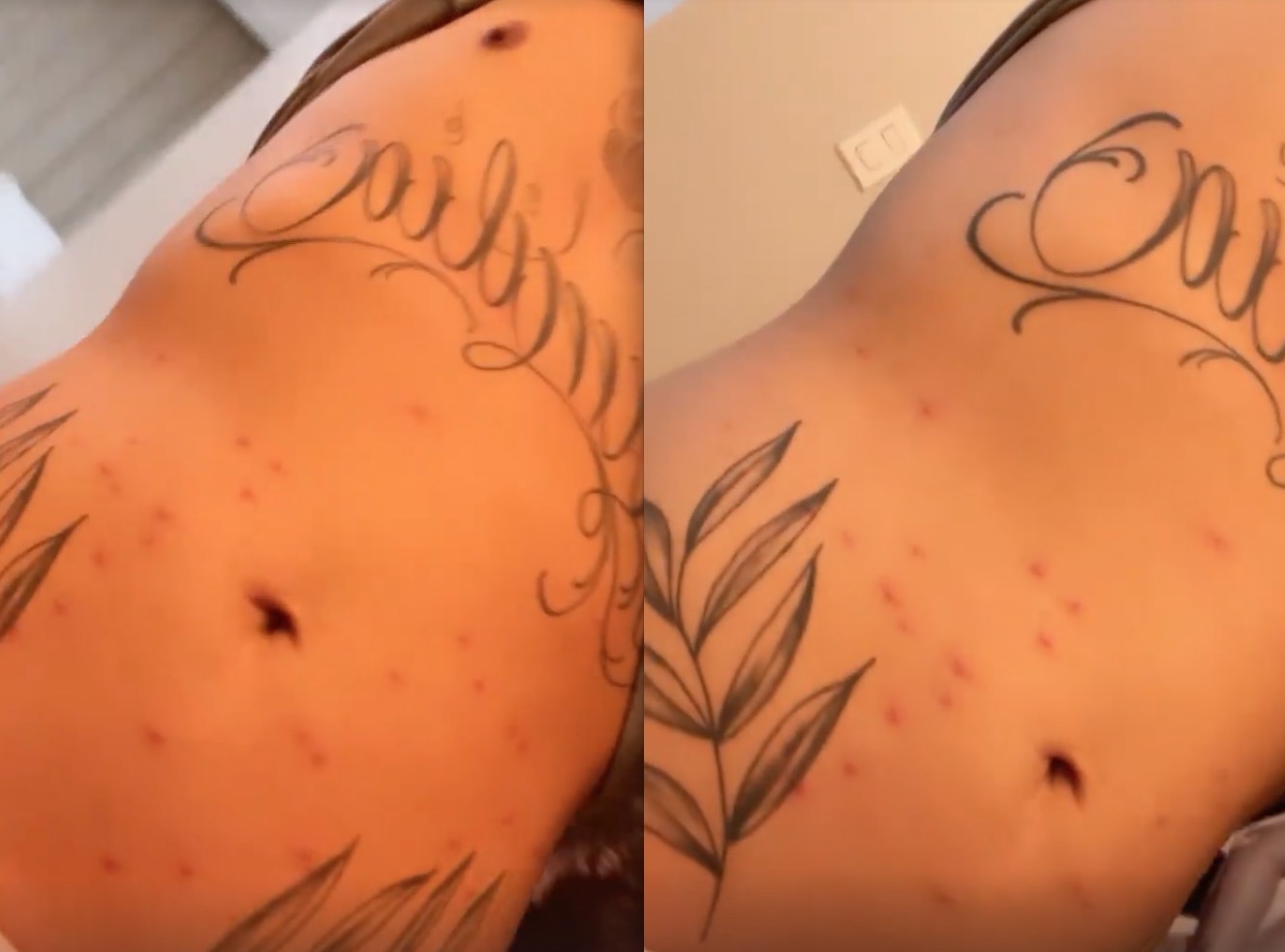 Corpo de Zé Felipe com manchas - Foto: Reprodução Instagram