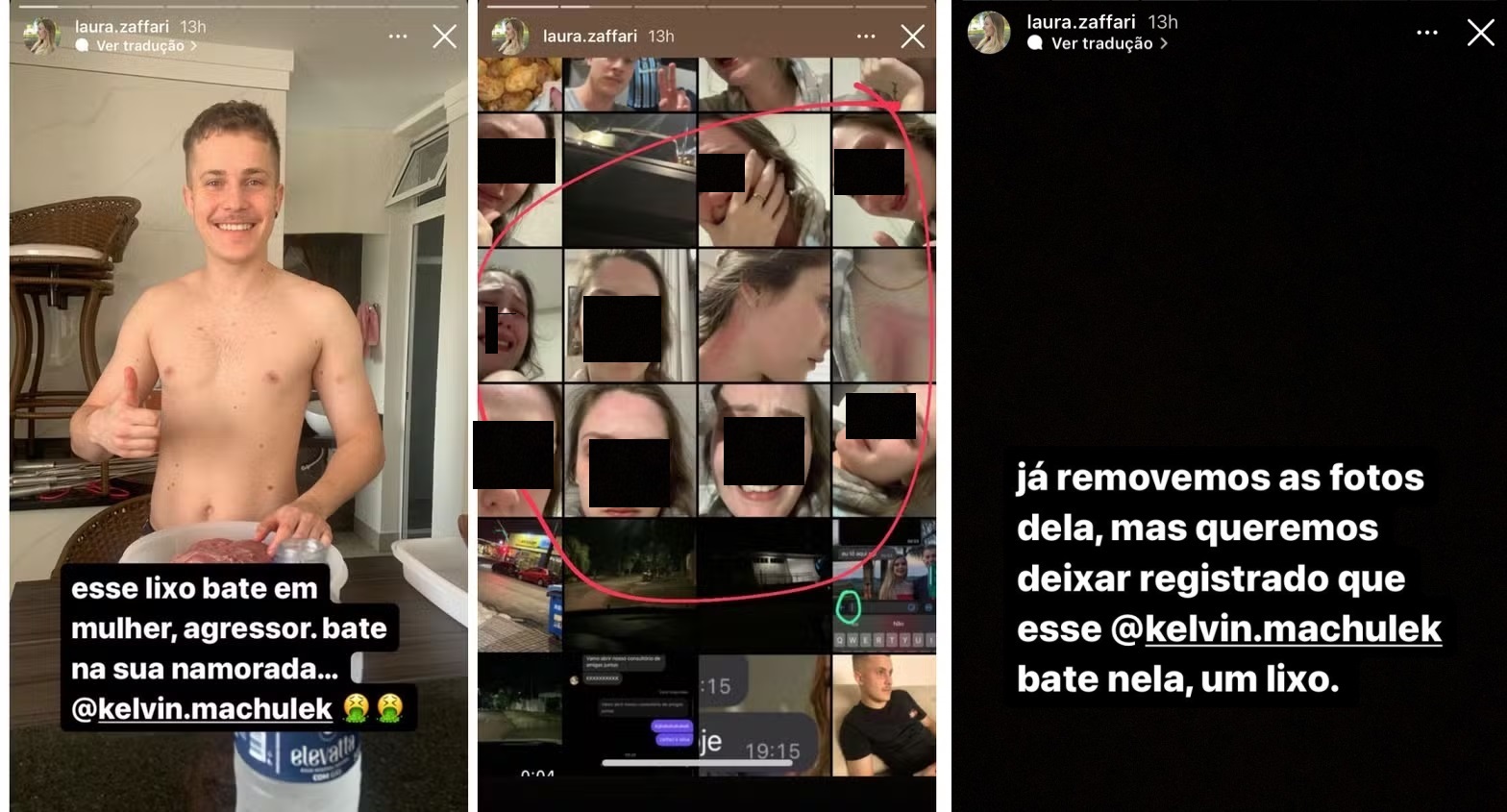 Mãe da vítima do furto afirma que a jovem sofreu alergia a shampoo e que criminosos estão 'publicando mentiras'.