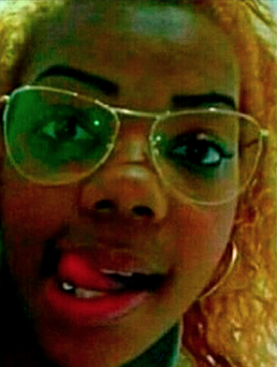 Ludmilla Antes e depois da Cantora após Cirurgias