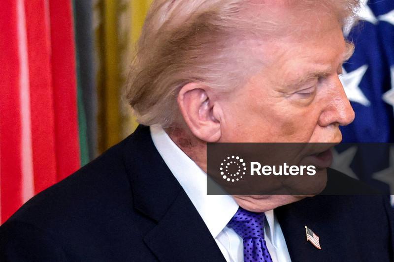 Casa Branca diz que Trump está usando tratamento preventivo para erupções cutâneas no pescoço, mas não dá detalhes