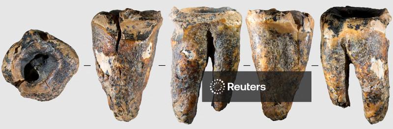 Dente em caverna da Sibéria revela cirurgia dentária em neandertal