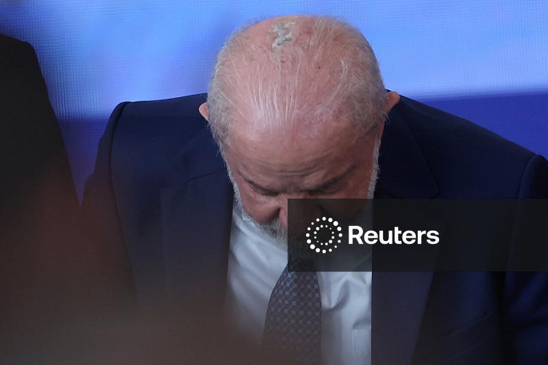 Lula conclui tratamento de radioterapia para câncer no couro cabeludo