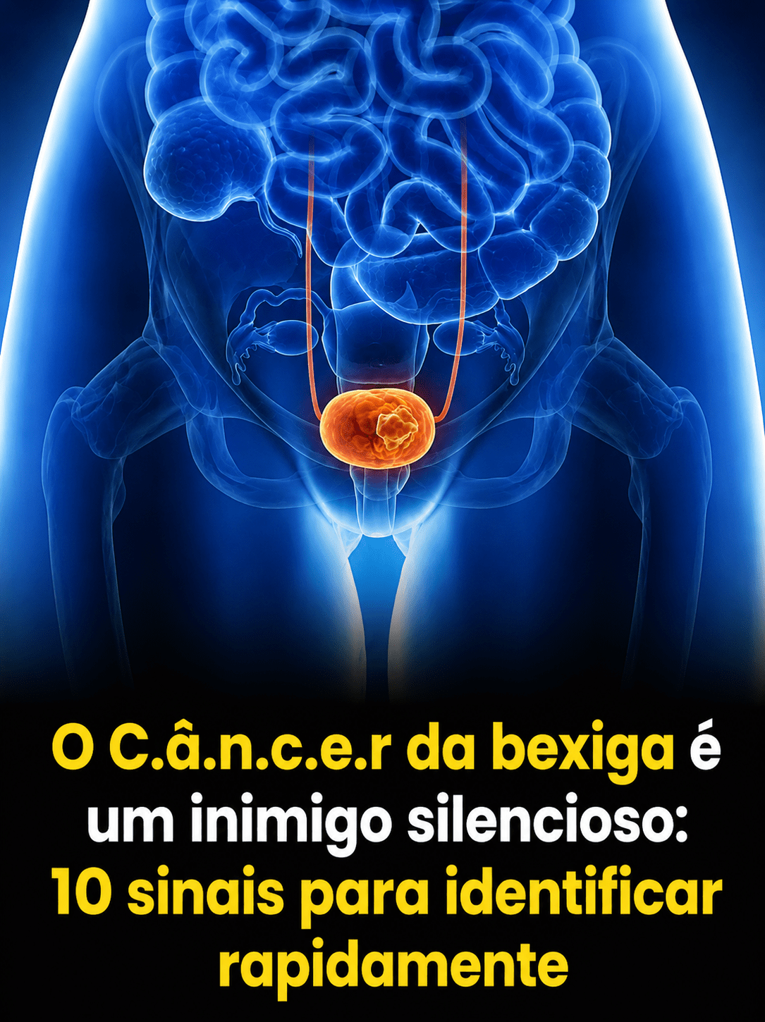 Câncer de bexiga: 10 sinais silenciosos que merecem atenção e avaliação médica