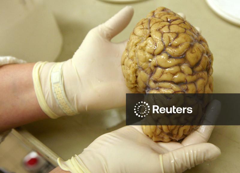 Cientistas mapeiam atividade gênica no córtex pré-frontal do cérebro