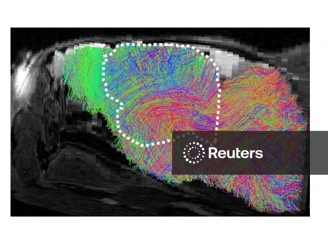 Cientistas transplantam tecido cerebral humano cultivado em laboratório em camundongos